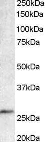 Anti-BCL7A Antibody (A82781) staining (1 µg/ml) of Human Lymphnode lysate (RIPA buffer, 35 µg total protein per lane) Primary incubated for 1 hour Detected by western blot using chemiluminescence