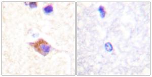 Immunohistochemical analysis of paraffin-embedded human brain using Anti-PLCG2 (phospho Tyr1217) Antibody. The right hand panel represents a negative control, where the antibody was pre-incubated with the immunising peptide