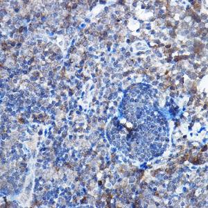 Immunohistochemistry analysis of paraffin-embedded rat lymph node using Anti-Bax Antibody [ARC5006-10] (A306010) at a dilution of 1:20ï¼Œ1:50 (40X lens). Perform high pressure antigen retrieval with 10 mM citrate buffer pH 6.0 before commencing with IHC staining protocol