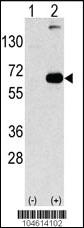 Anti-SQSTM1 (p62) Rabbit Polyclonal Antibody