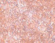 Anti-JMJD8 Rabbit Polyclonal Antibody