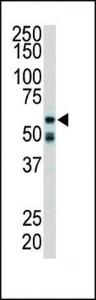 Anti-RIPK2 Rabbit Polyclonal Antibody (AP (Alkaline Phosphatase))