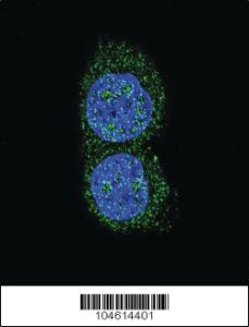 Anti-SQSTM1 (p62) Rabbit Polyclonal Antibody