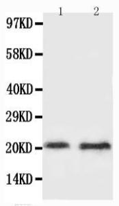 Anti-BNIP3 Rabbit Polyclonal Antibody