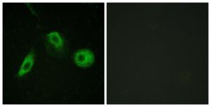 Immunofluorescence analysis of HeLa cells using Anti-PLCG2 (phospho Tyr1217) Antibody. The right hand panel represents a negative control, where the antibody was pre-incubated with the immunising peptide