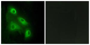 Antibody anti-EPS8L3 100 µg