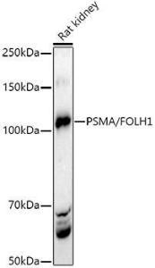 Western blot analysis of extracts of Rat kidney, using Anti-PSMA Antibody (A308937) at 1:500 dilution