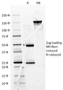 SDS-PAGE analysis of Anti-CD74 Antibody [BU45] under non-reduced and reduced conditions; showing intact IgG and intact heavy and light chains, respectively. SDS-PAGE analysis confirms the integrity and purity of the antibody