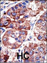 Anti-SQSTM1 (p62) Rabbit Polyclonal Antibody