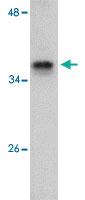 Anti-JMJD8 Rabbit Polyclonal Antibody