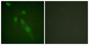 Immunofluorescence analysis of HeLa cells using Anti-Lys-Acetylated Proteins Antibody. The right hand panel represents a negative control, where the antibody was pre-incubated with the immunising peptide