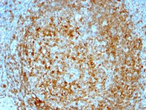 Immunohistochemical analysis of formalin-fixed, paraffin-embedded human tonsil using Anti-CD74 Antibody [CLIP/813]