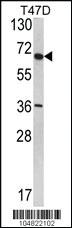 Anti-SYVN1 Rabbit Polyclonal Antibody