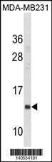 Anti-IFITM1 Rabbit Polyclonal Antibody (PE (Phycoerythrin))