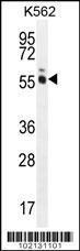 Anti-MAGEL2 Rabbit Polyclonal Antibody (AP (Alkaline Phosphatase))