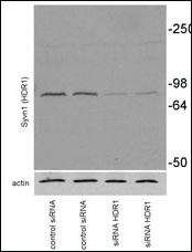 Anti-SYVN1 Rabbit Polyclonal Antibody