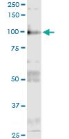 Anti-ITGB6 Polyclonal Antibody Pair