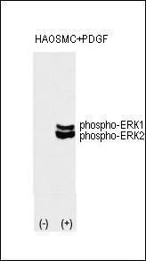 Anti-MAPK3 Rabbit Polyclonal Antibody (HRP (Horseradish Peroxidase))