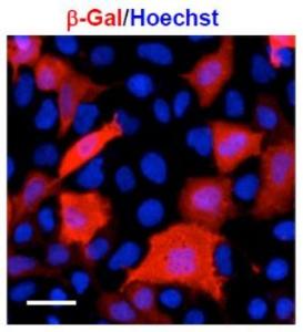 Anti-beta Galactosidase Antibody