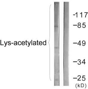 Western blot analysis of lysates from COS7 cells treated with TSA 400uM 24h using Anti-Lys-Acetylated Proteins Antibody. The right hand lane represents a negative control, where the antibody is blocked by the immunising peptide