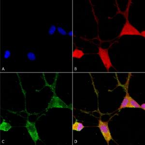 Immunocytochemistry/Immunofluorescence analysis of human neuroblastoma cells (SH-SY5Y), fixed in 4% PFA for 15 min, using Anti-VGluT1 Antibody [S28-9] (A304823), at 1:100 for overnight at 4°C with slow rocking