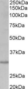 Antibody anti-CRLS1 100 µg