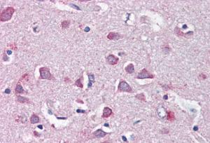 Anti-Merlin Antibody (A84381) (5 µg/ml) staining of paraffin embedded Human Cortex. Steamed antigen retrieval with citrate buffer pH 6, AP-staining