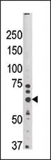 Anti-SYVN1 Rabbit Polyclonal Antibody