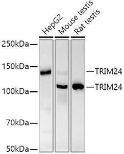 Western blot analysis of extracts of various cell lines, using Anti-TRIM24 Antibody [ARC2920] (A308939) at 1:1,000 dilution. The secondary antibody was Goat Anti-Rabbit IgG H&L Antibody (HRP) at 1:10,000 dilution.