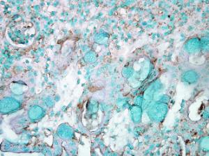 Immunohistochemistry analysis of mouse inflamed colon, fixed in formalin