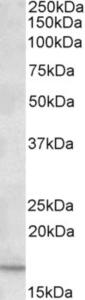 EB09352 (0.2 µg/ml) staining of Human Duodenum lysate (35 µg protein in RIPA buffer). Primary incubation was 1 hour. Detected by chemiluminescence