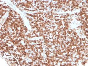 Immunohistochemical analysis of formalin-fixed, paraffin-embedded human tonsil using Anti-CD74 Antibody [rCLIP/813]