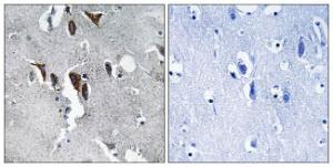 Immunohistochemical analysis of paraffin-embedded human brain tissue using Anti-ELOVL5 Antibody The right hand panel represents a negative control, where the antibody was pre-incubated with the immunising peptide