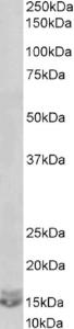 EB09352 (0.03 µg/ml) staining of Daudi lysate (35 µg protein in RIPA buffer). Primary incubation was 1 hour. Detected by chemiluminescence