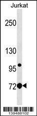 Anti-LCP1 Rabbit Polyclonal Antibody