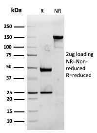 SDS-PAGE analysis of Anti-CD74 Antibody [rCLIP/813] under non-reduced and reduced conditions; showing intact IgG and intact heavy and light chains, respectively. SDS-PAGE analysis confirms the integrity and purity of the antibody