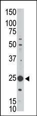 Anti-MAGEH1 Rabbit Polyclonal Antibody (AP (Alkaline Phosphatase))