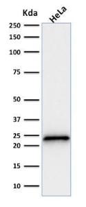 Antibody anti-P21 SPM306 100 µg