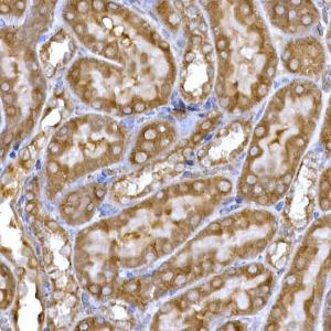 Immunohistochemistry analysis of paraffin-embedded rat kidney using Anti-PPP1R3C Antibody (A307722) at a dilution of 1:50 (40X lens). Perform high pressure antigen retrieval with 10 mM citrate buffer pH 6.0 before commencing with IHC staining protocol