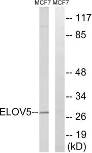 Western blot analysis of lysates from MCF-7 cells using Anti-ELOVL5 Antibody The right hand lane represents a negative control, where the antibody is blocked by the immunising peptide