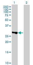 Anti-TBC1D7 Mouse Polyclonal Antibody