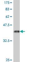 Anti-FOLH1 Mouse Polyclonal Antibody