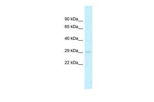 Anti-AGPAT2 Rabbit Polyclonal Antibody