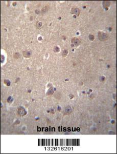 Anti-SNX4 Rabbit Polyclonal Antibody (AP (Alkaline Phosphatase))