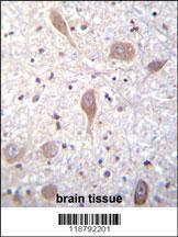 Anti-F-spondin Rabbit Polyclonal Antibody (HRP (Horseradish Peroxidase))