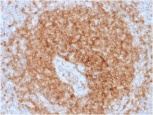 Immunohistochemical analysis of formalin-fixed, paraffin-embedded human spleen using Anti-CD79a Antibody [rIGA/764]