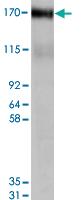 Anti-ABCC4 Goat Polyclonal Antibody