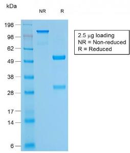 SDS-PAGE analysis of Anti-CD79a Antibody [rIGA/764] under non-reduced and reduced conditions; showing intact IgG and intact heavy and light chains, respectively SDS-PAGE analysis confirms the integrity and purity of the antibody