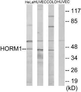 Anti-HORMAD1 antibody