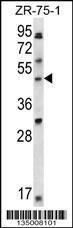 Anti-LDB1 Rabbit Polyclonal Antibody